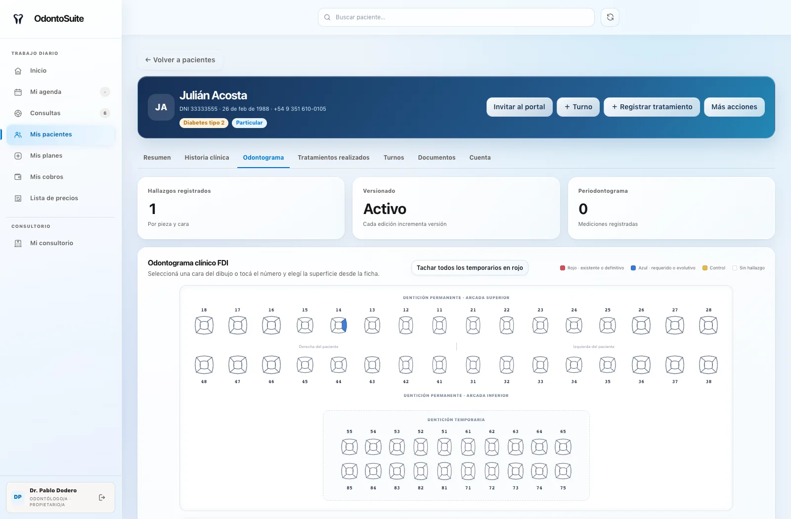 Odontograma clínico FDI integrado en OdontoSuite con datos ficticios de demostración